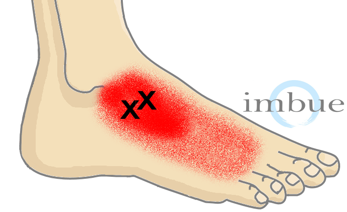 Pain on top of foot above ankle, how to relieve a ingrown toenail, ball