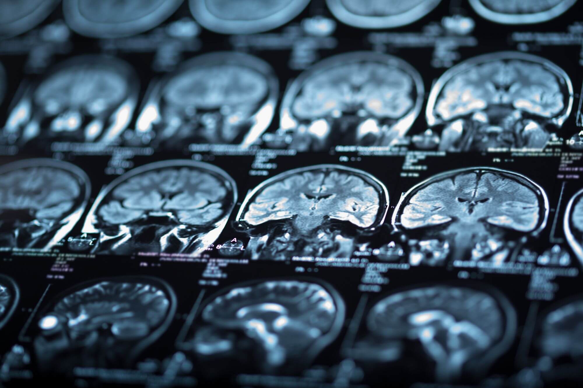 Request a Radiology Appt. in Twin Falls Innovative Medical Imaging