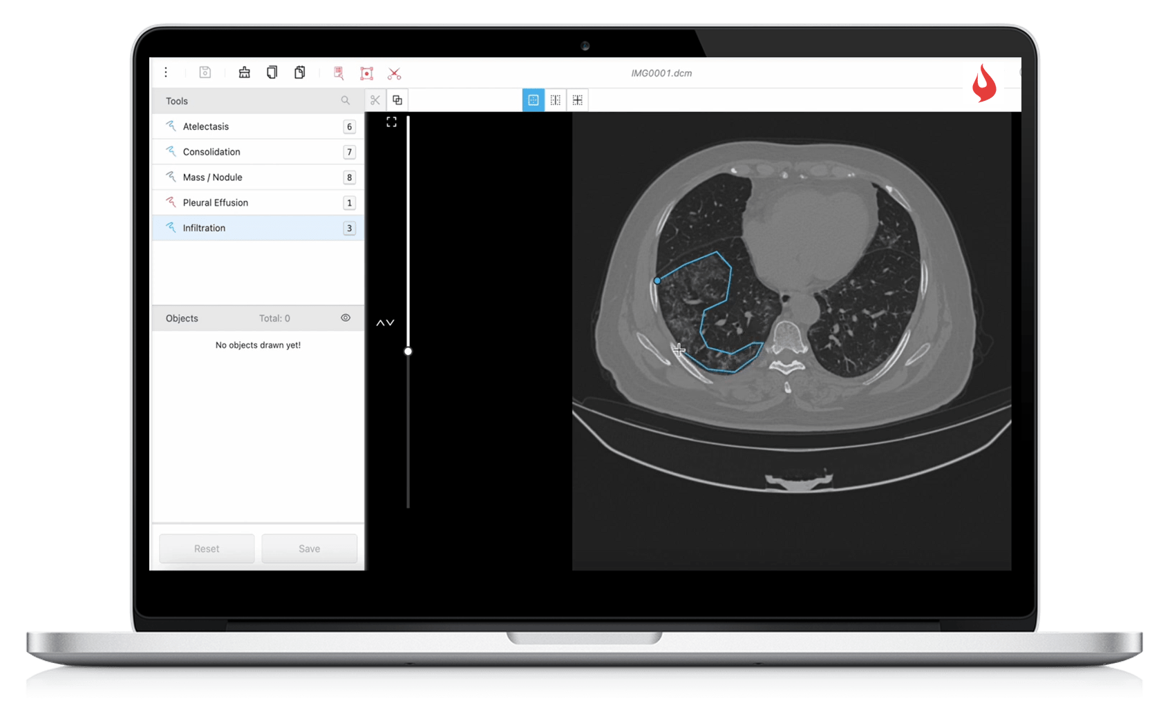 Data Annotation for Digital Radiology iMerit