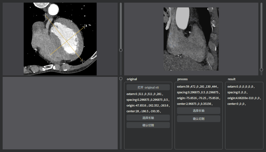 studyvtk三维影像实现任意方向大小的切割