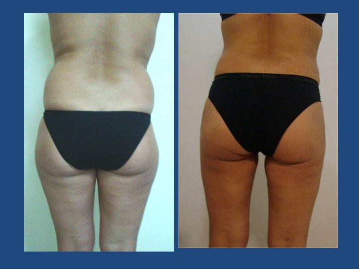 Istanbul Aesthetic Plastic Surgery Center in Turkey 152 reviews