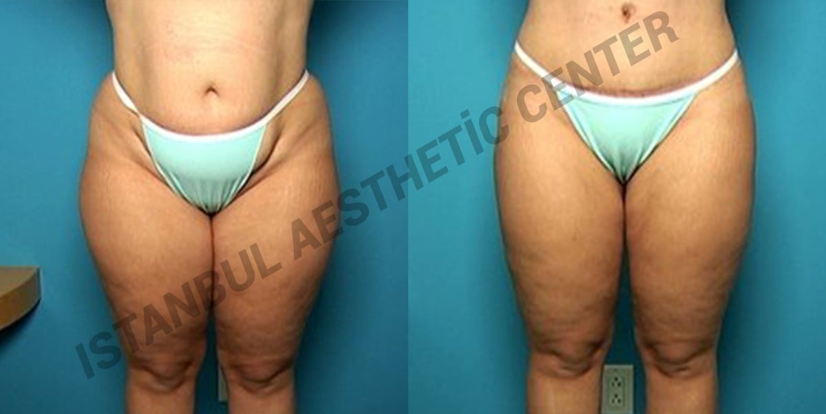 Istanbul Aesthetic Plastic Surgery Center in Turkey 154 reviews