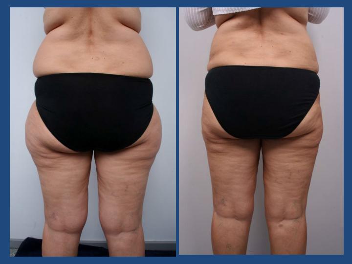 Istanbul Aesthetic Plastic Surgery Center in Turkey 141 reviews