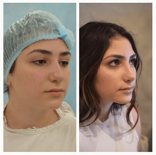 38 Best Plastic Surgery clinics in Mexico price‎s, doctors and reviews