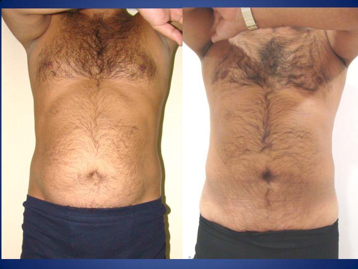 Istanbul Aesthetic Plastic Surgery Center in Turkey 152 reviews