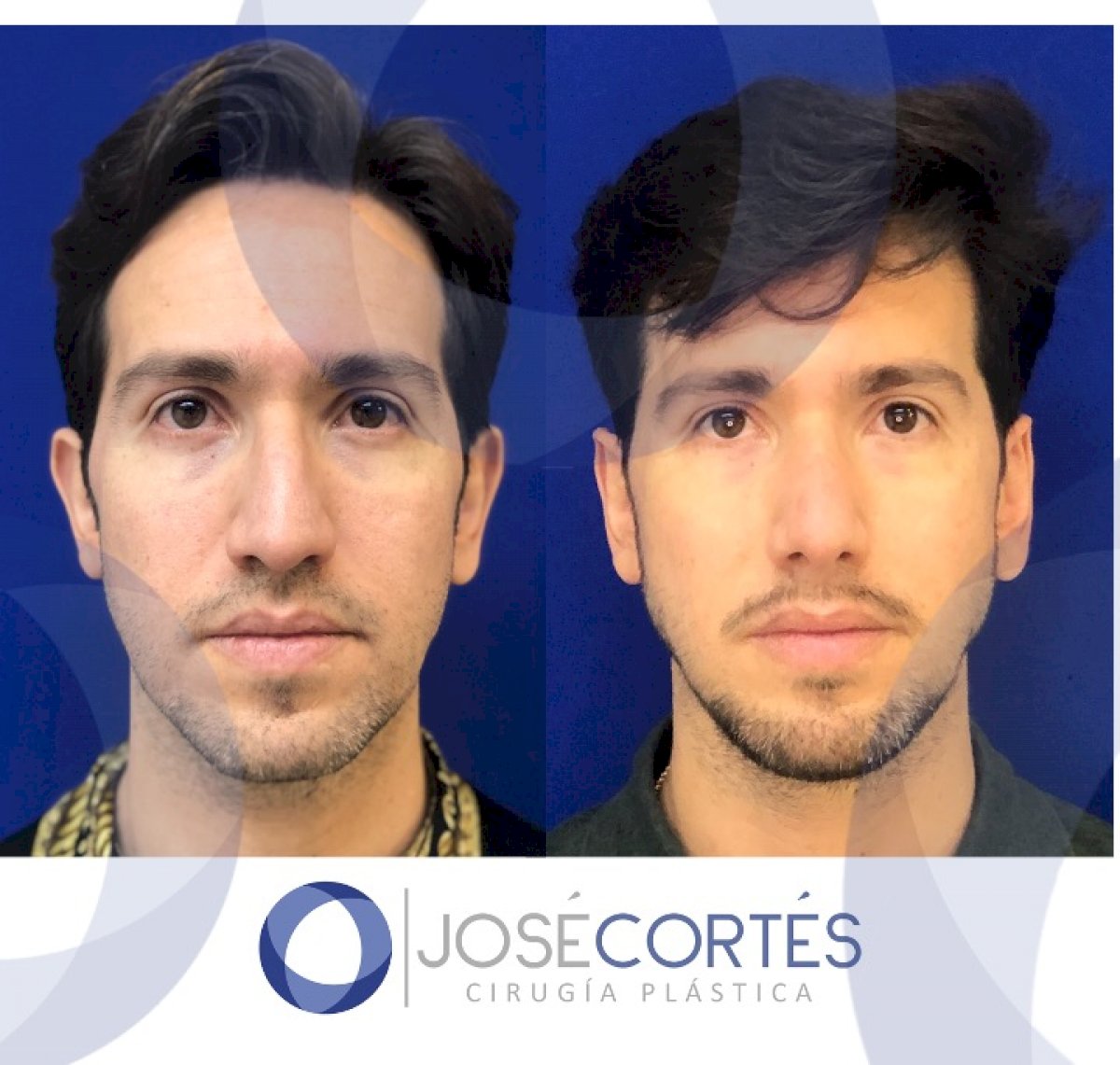 38 Best Plastic Surgery clinics in Mexico price‎s, doctors and reviews