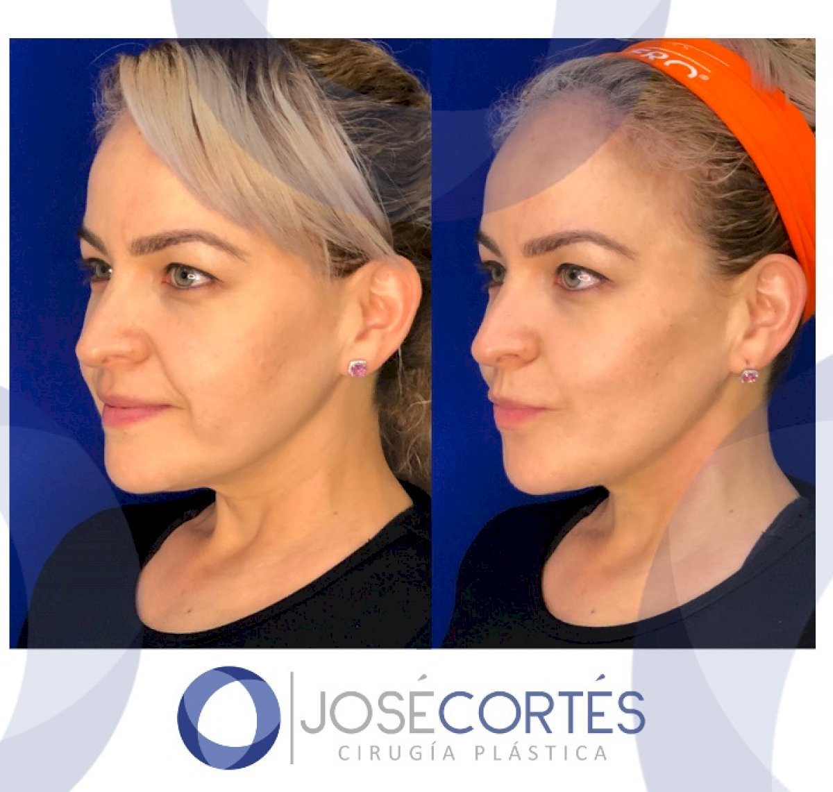 38 Best Plastic Surgery clinics in Mexico price‎s, doctors and reviews