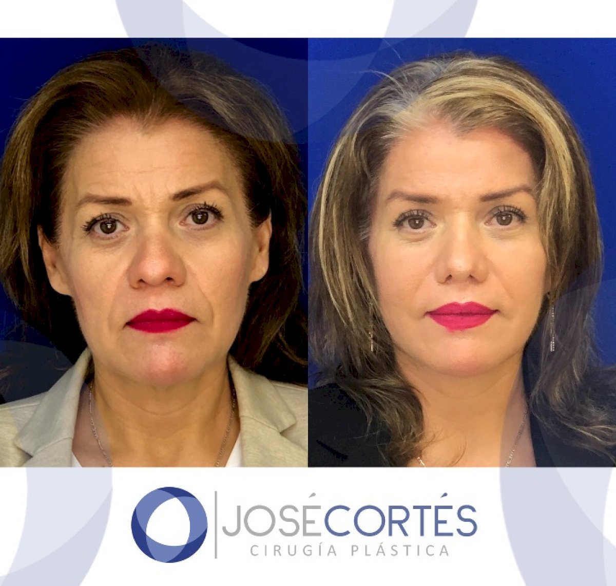 38 Best Plastic Surgery clinics in Mexico price‎s, doctors and reviews