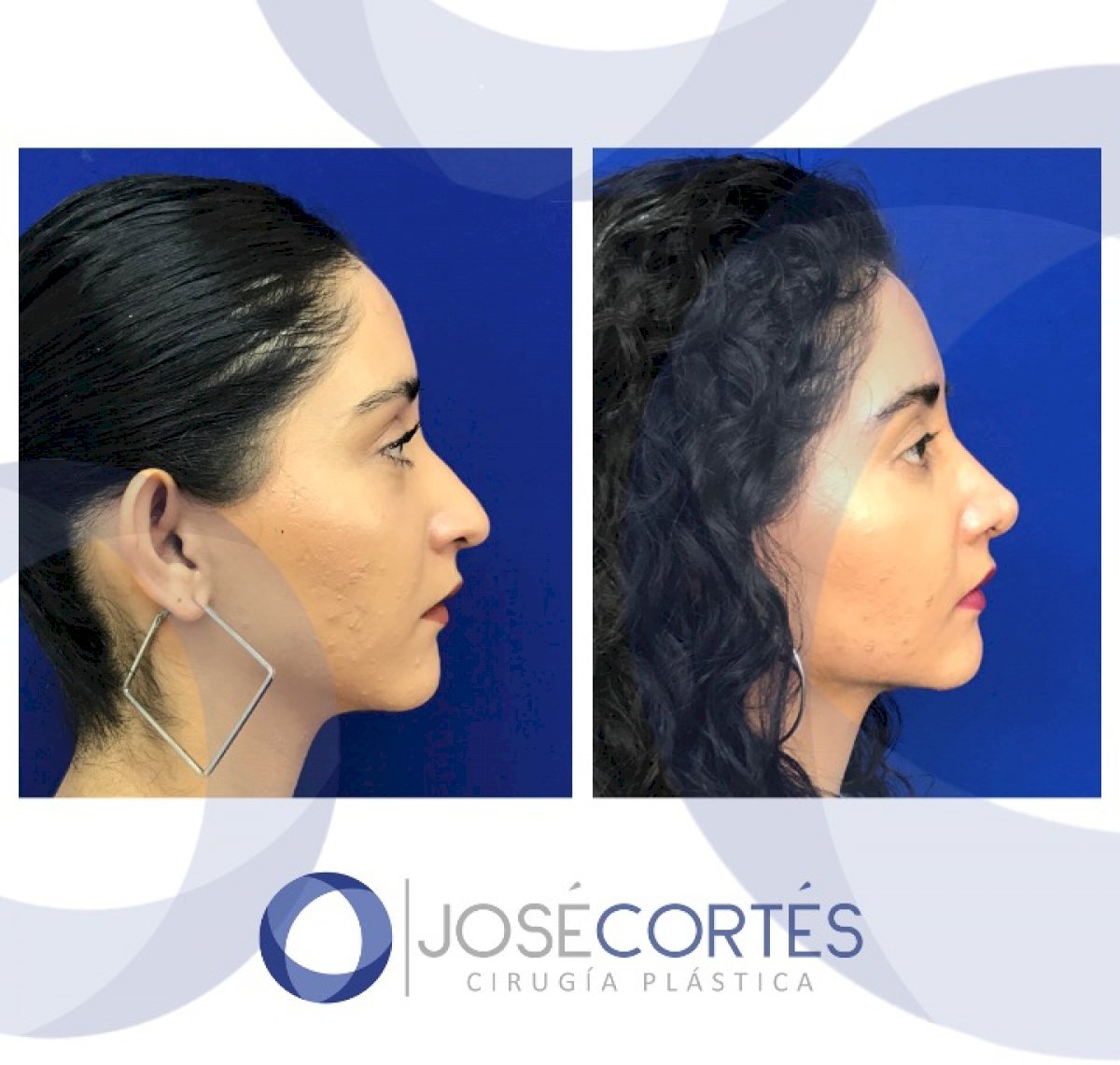 38 Best Plastic Surgery clinics in Mexico price‎s, doctors and reviews