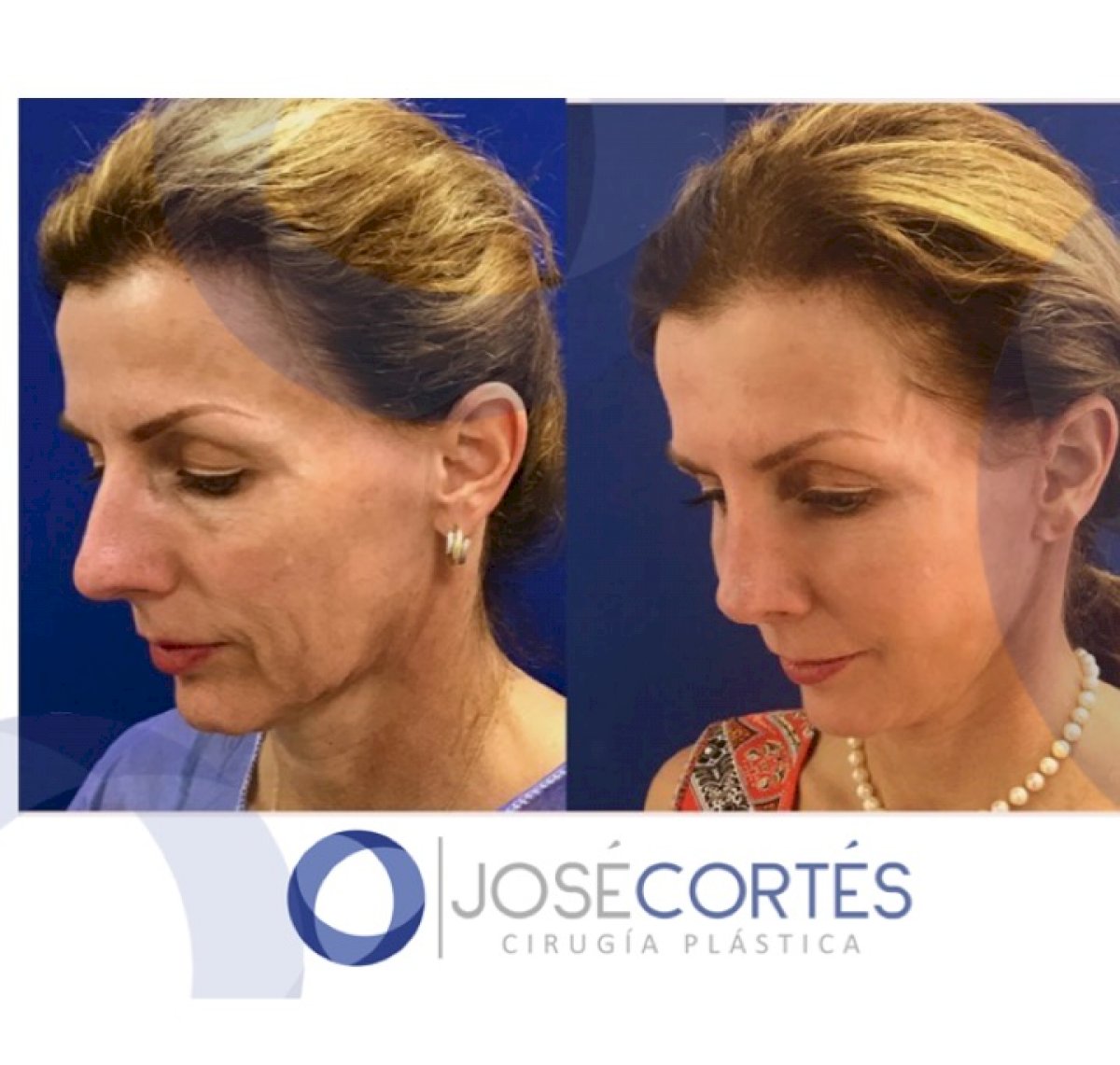 38 Best Plastic Surgery clinics in Mexico price‎s, doctors and reviews