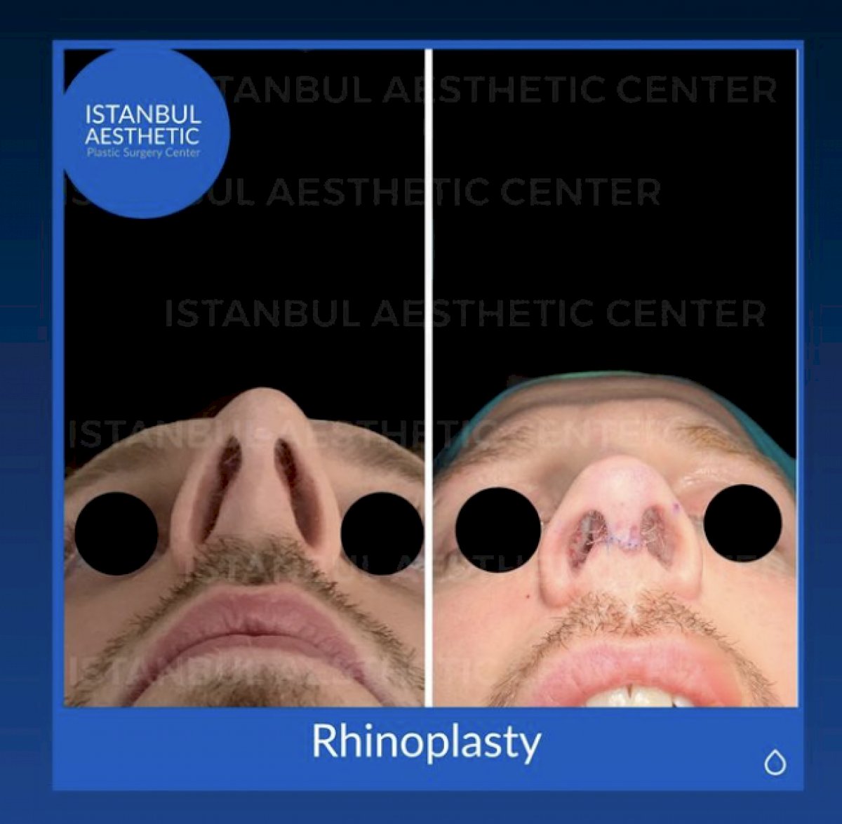 Istanbul Aesthetic Plastic Surgery Center in Turkey 154 reviews