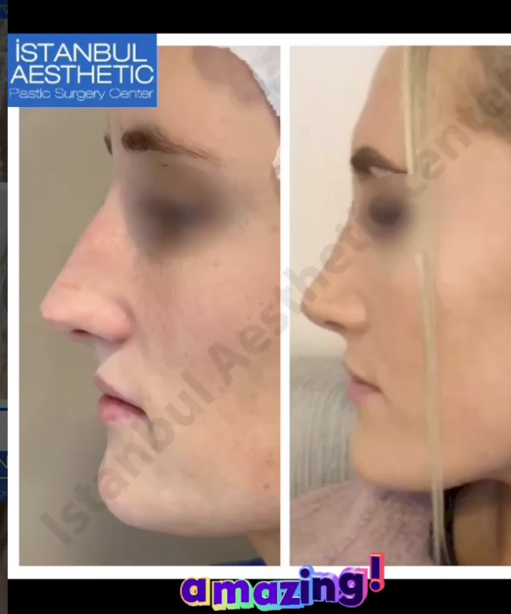 Istanbul Aesthetic Plastic Surgery Center in Turkey 154 reviews