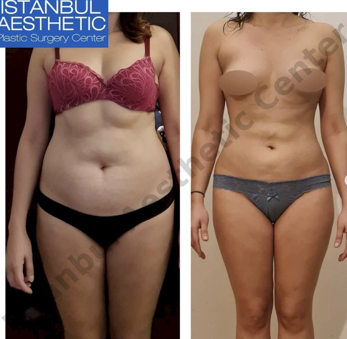 Istanbul Aesthetic Plastic Surgery Center in Turkey 141 reviews