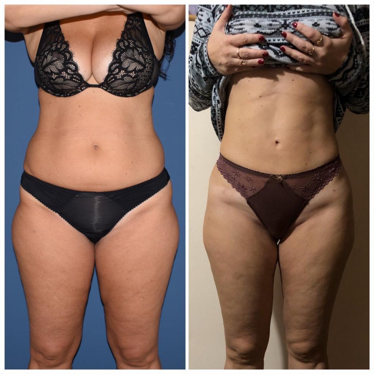 Istanbul Aesthetic Plastic Surgery Center in Turkey 152 reviews