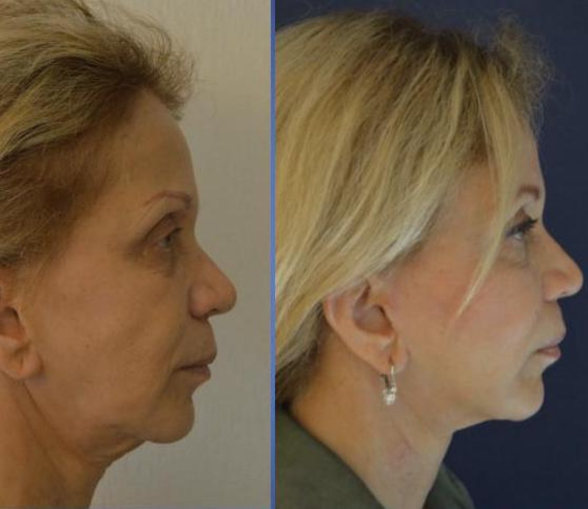 Istanbul Aesthetic Plastic Surgery Center in Turkey 144 reviews