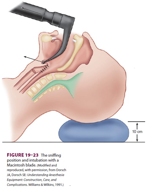 Techniques of Direct and Indirect Laryngoscopy & Intubation