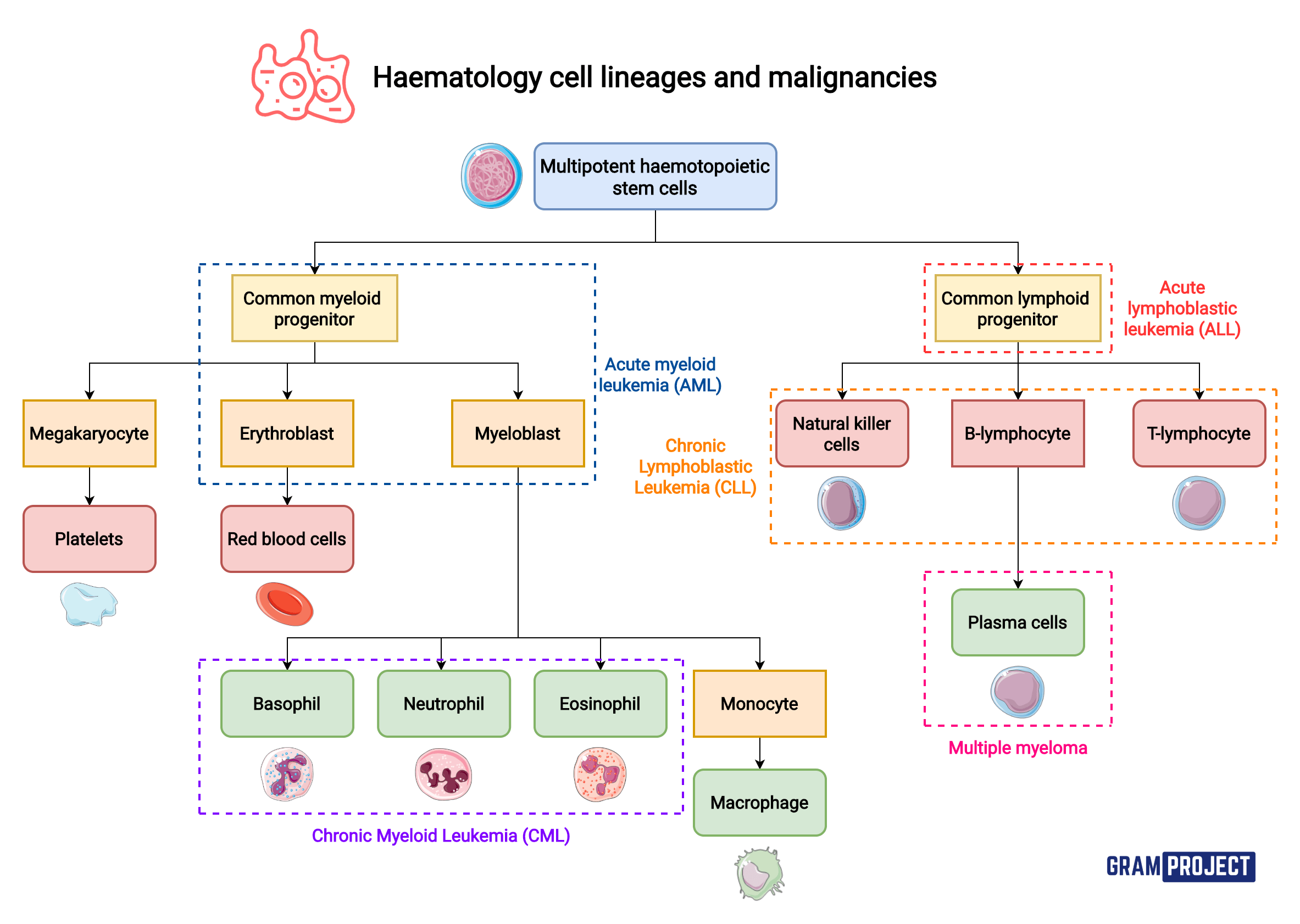 Summary of haemotology cell lineages and the malignancies GrepMed