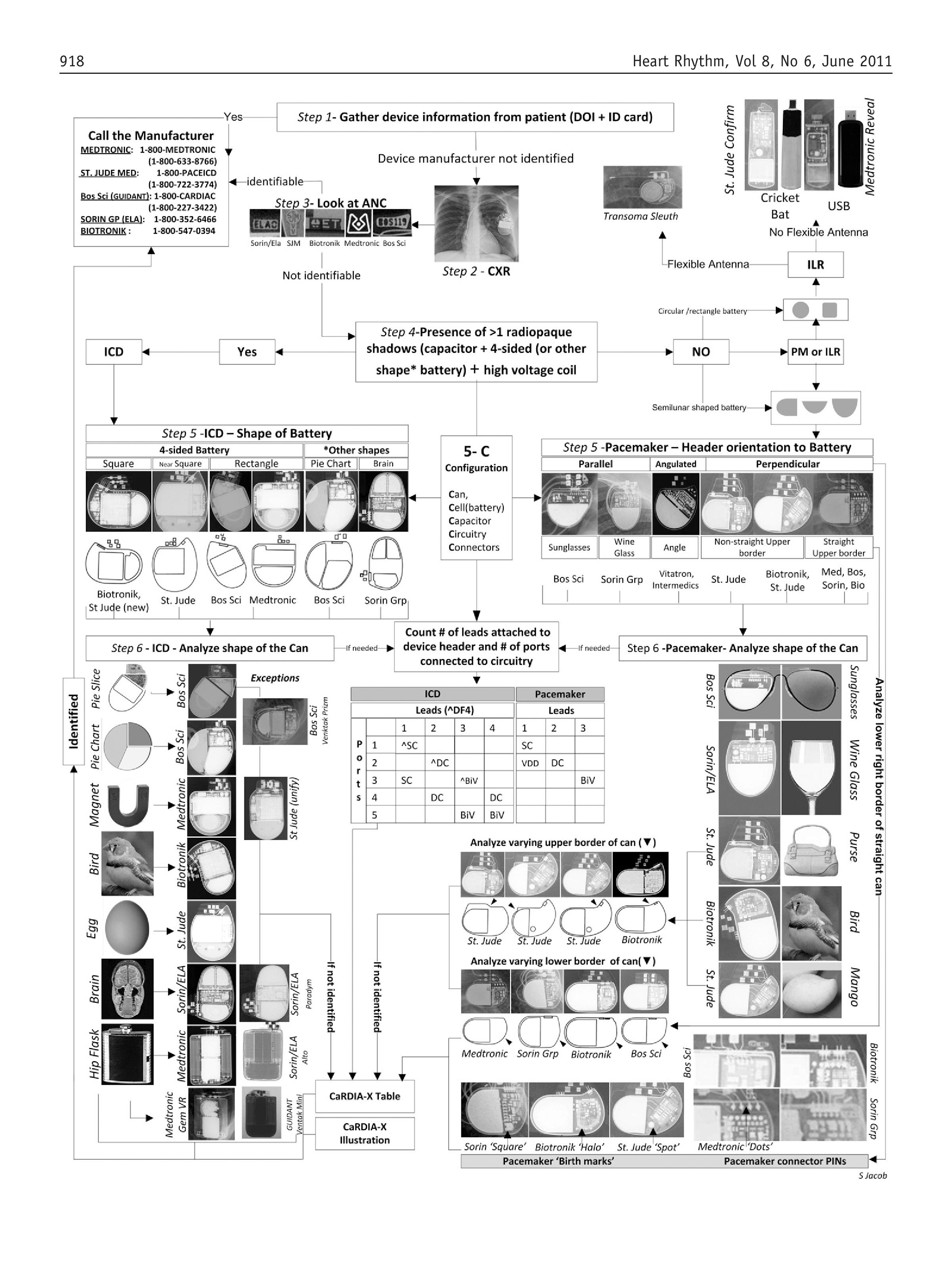 Icd Vs Pacemaker Cxr Chest xray PA. Male patient, VVIRpacemaker on