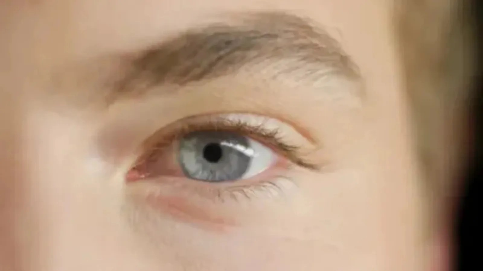 I'm A Doctor ― This Eye Colour Change Can Reveal Heart Health Issues