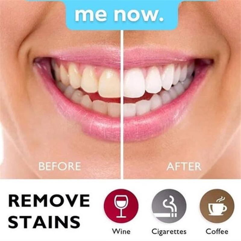 Buy 1 PC 3D White Teeth Whitening Pen Tooth Gel Whitener Bleach Remove