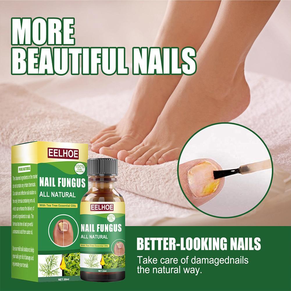 Buy 30ml Nail Fungus Treatment Antifungal Nail Solution Ringworm Clear