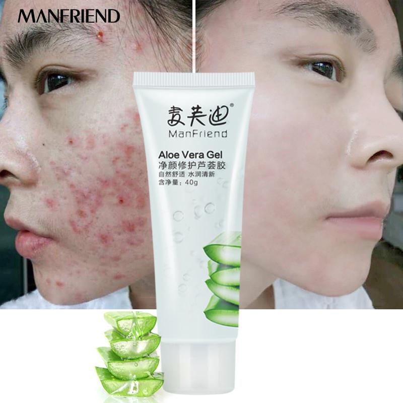 Buy Aloe Vera Gel Can Nourish The Injured Skin After Sun Exposure