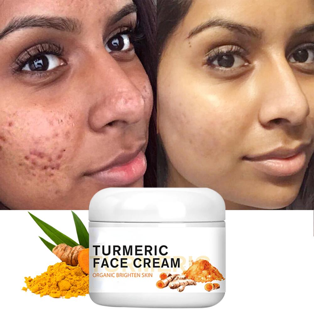 Cheap Turmeric Face Whitening Cream for Dark Skin Remove Acne Lighten