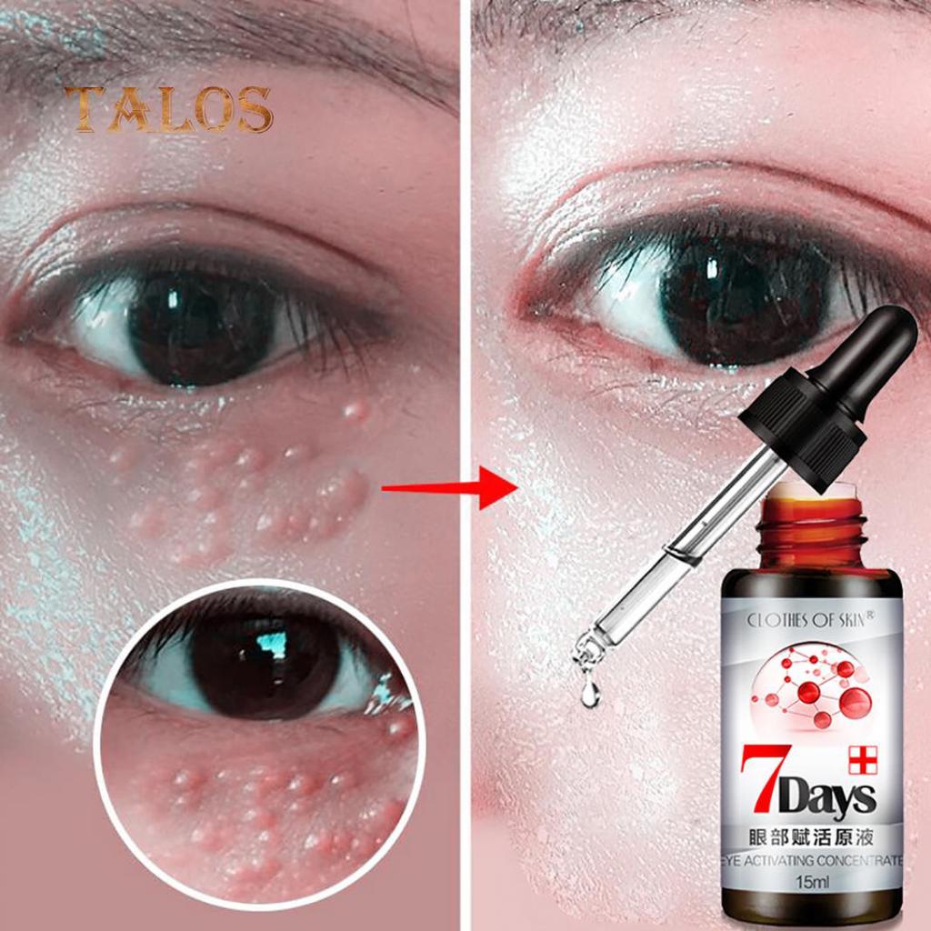 Buy 15ml Natural Ingredient Hydrating Black Circle Remove Eye Skin