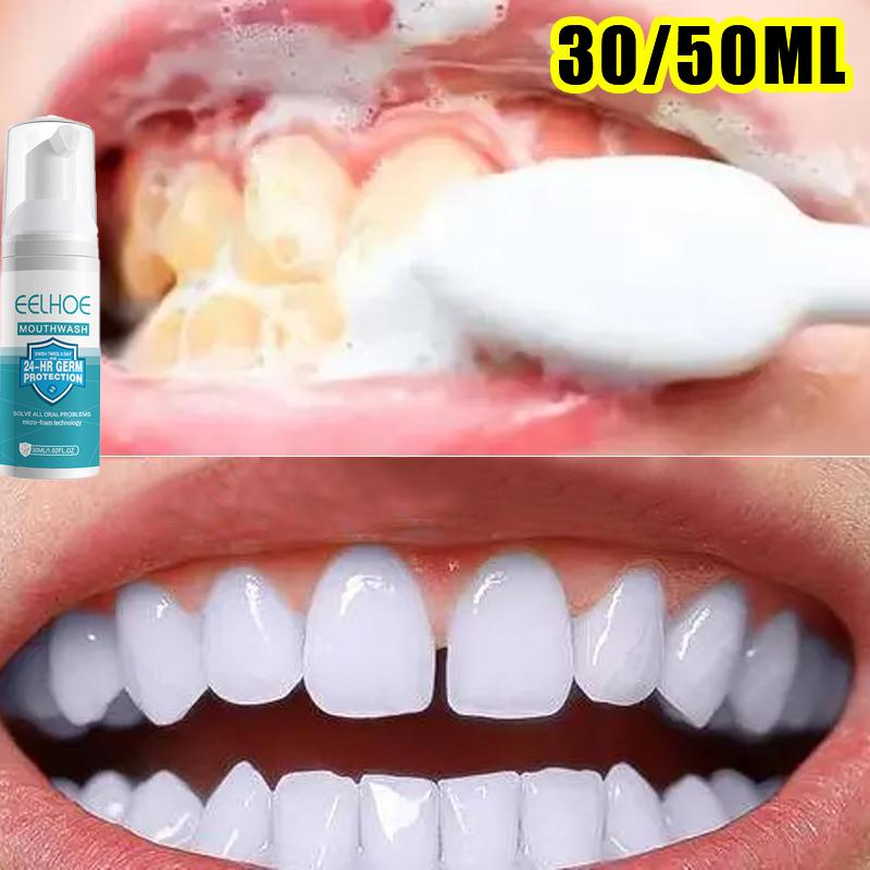 Cheap Tooth Stain Removal Gum Bleeding Whitening Deep Cleaning Dental