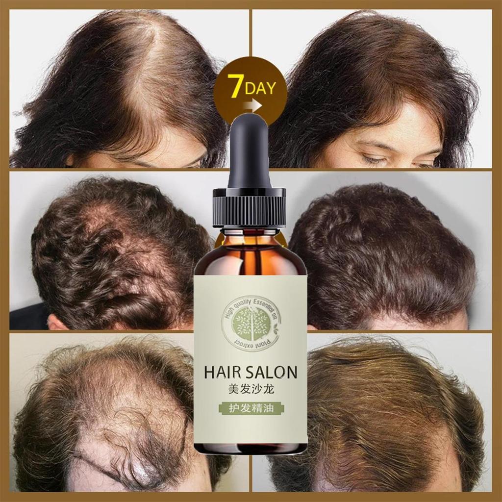 Cheap Hair Growth Essence Thick AntiAlopecia Hair Improvement Hair