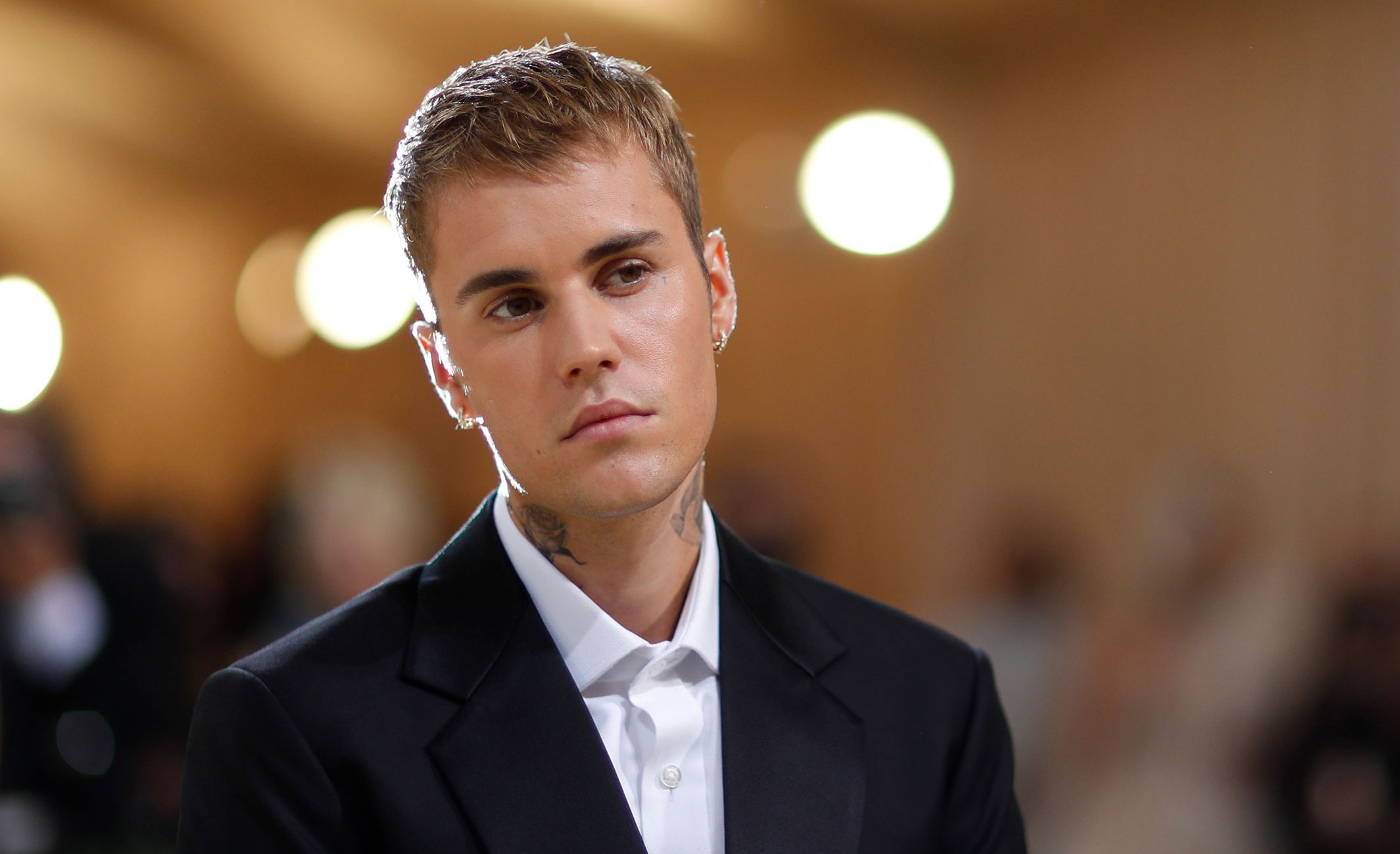 Justin Bieber says he has facial paralysis due to Ramsay Hunt syndrome