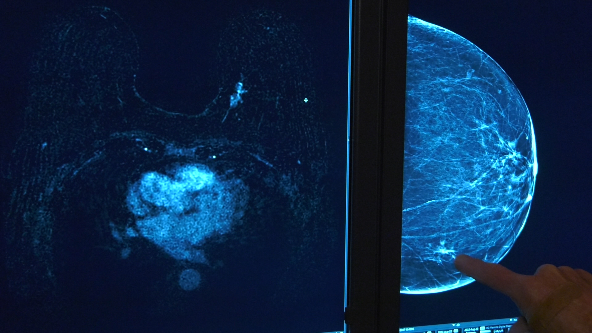 Intermountain Healthcare unveils new imaging tool for breast cancer