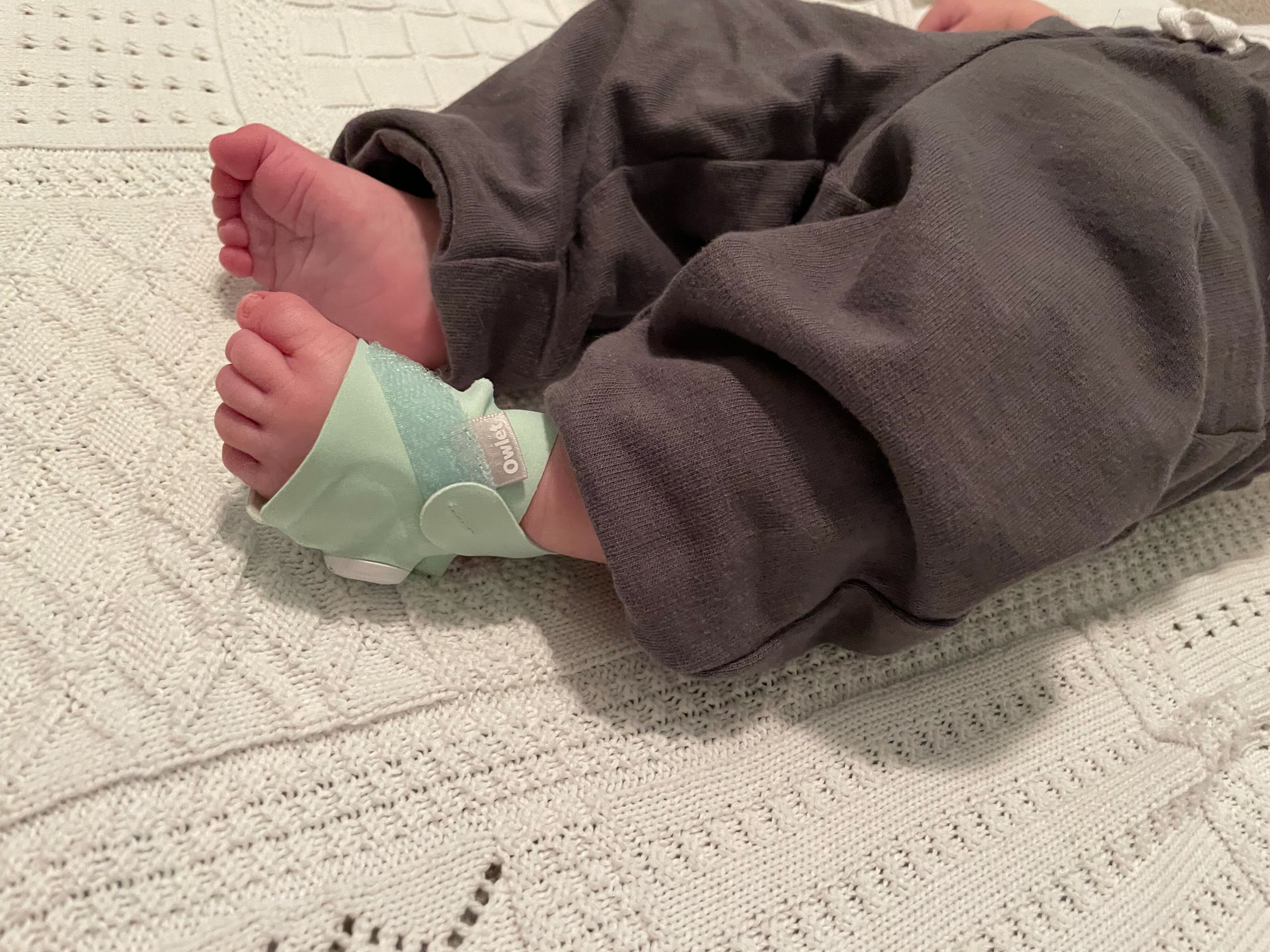 Owlet baby sock receives FDA clearance to launch medicalgrade health