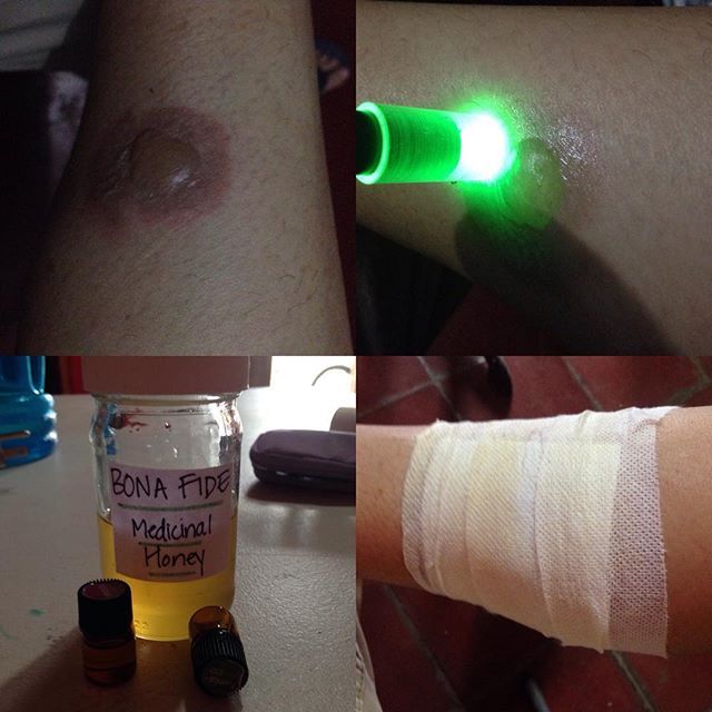 Lavender Oil Benefits And Uses For Burns Lavender Tips