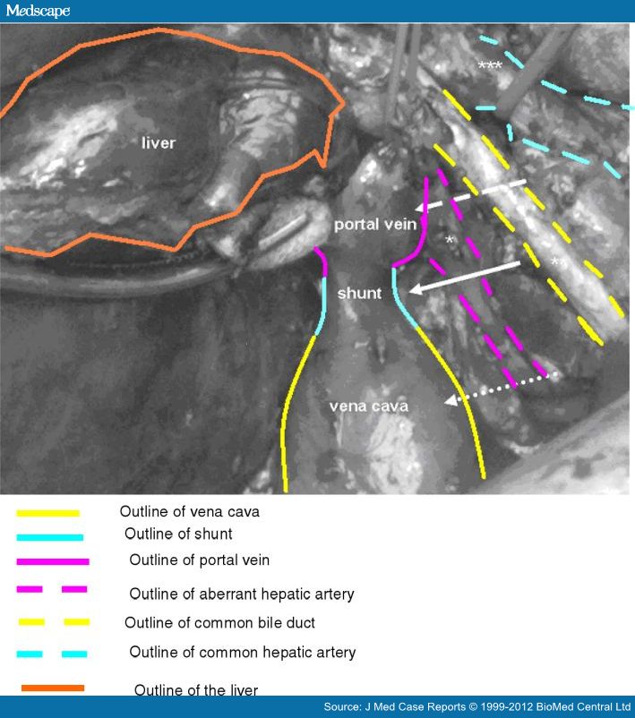 Management Strategy After Diagnosis of Malformation