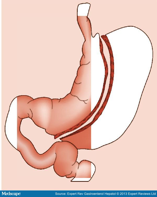 Does Being Pregnant Ruin Your Teeth