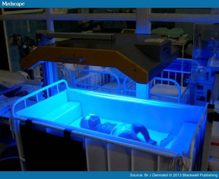 Longterm Hazards of Neonatal BlueLight Phototherapy