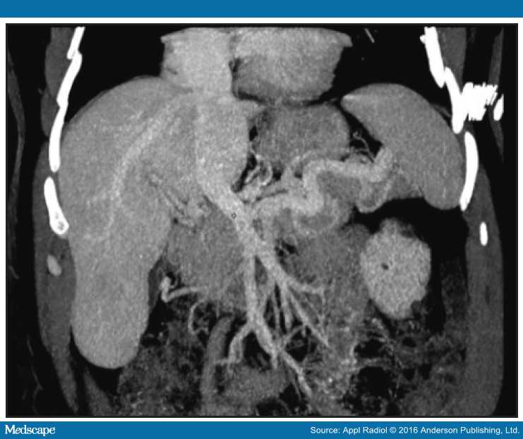 Radiological Case Malformation