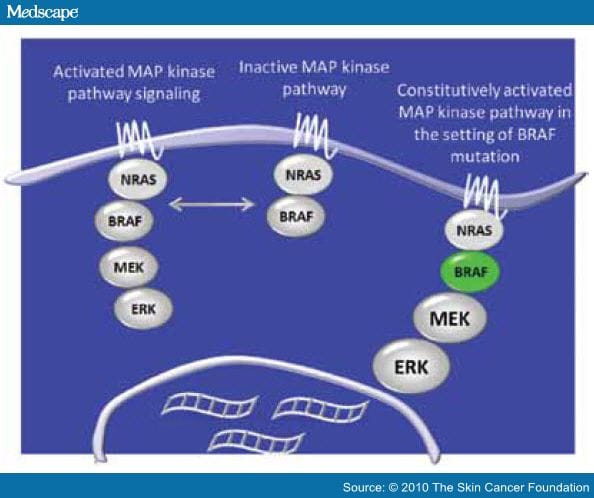 Targeted Melanoma Therapy May Change Treatment Landscape