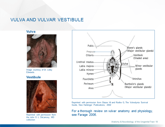 Vulvodynia A Common and UnderRecognized Pain Disorder in