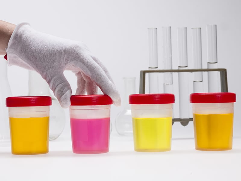 Gelb ist gesund Die 9 Farben des Urins alles klar?