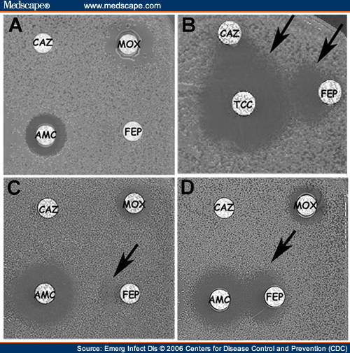 BetaLactamaseProducing Baumannii