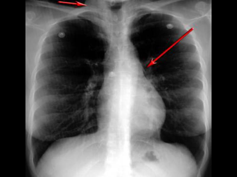 Teste Você consegue identificar achadoschave em radiografias?