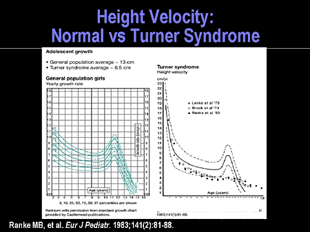 Turner Syndrome: Toward Early Recognition and Improved Outcomes