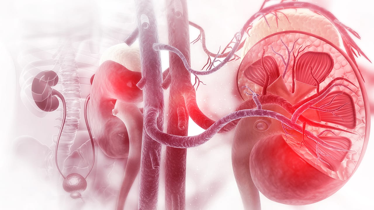 Renal Cell Carcinoma Imaging Practice Essentials, Radiography