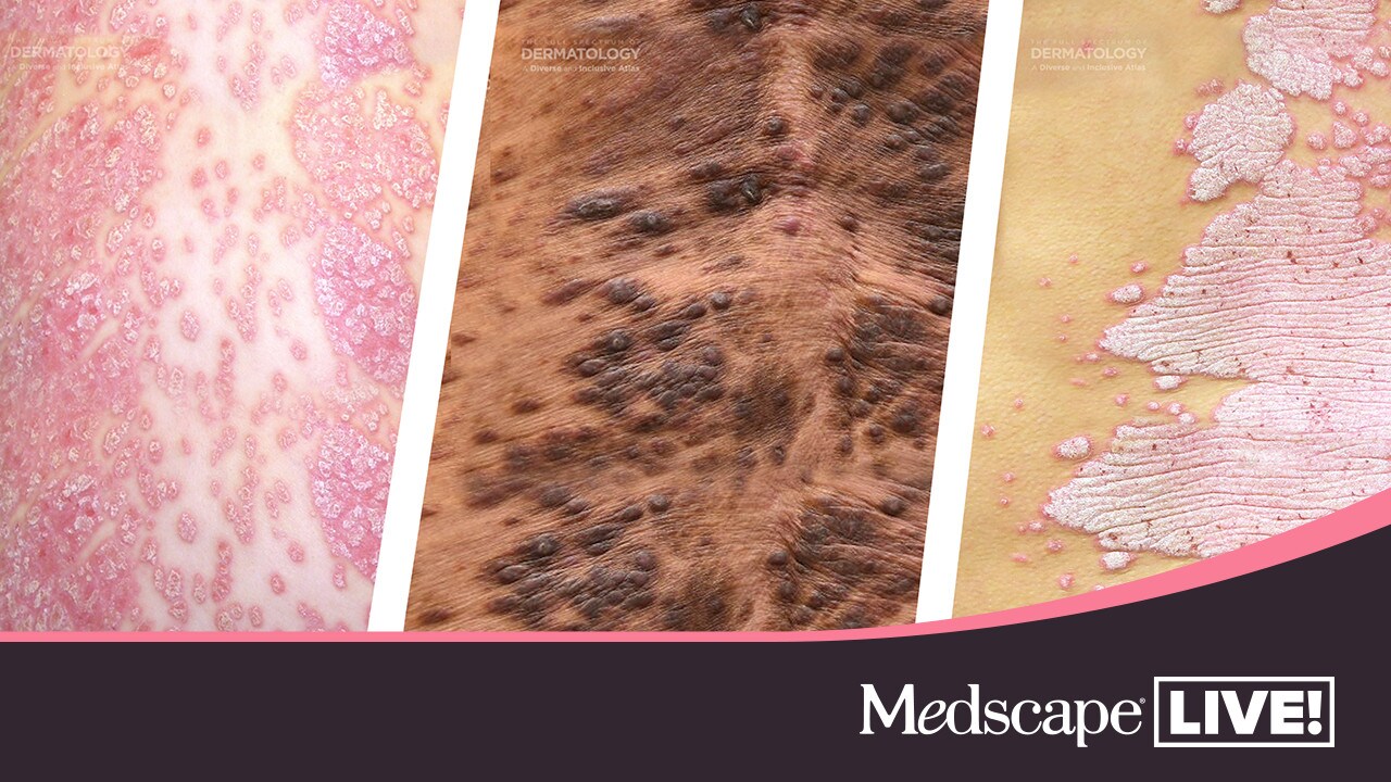 Nurses Knowledge & Practice Index