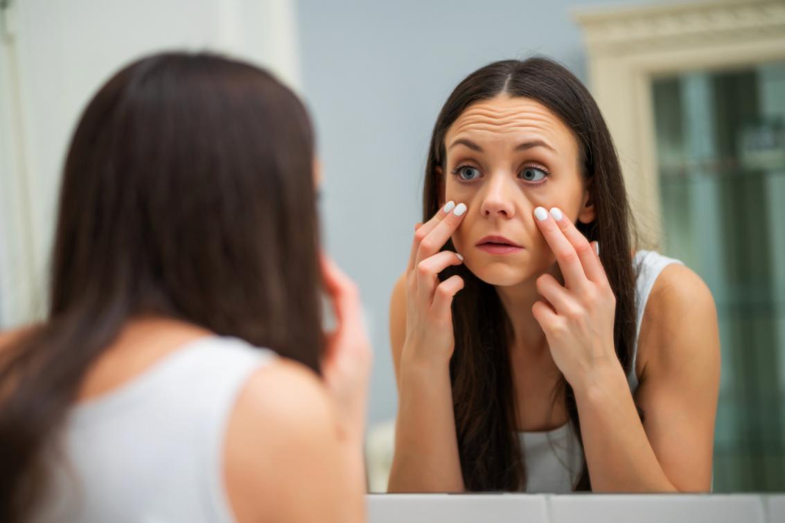 5 Natural Remedies to Cure Eye Bags