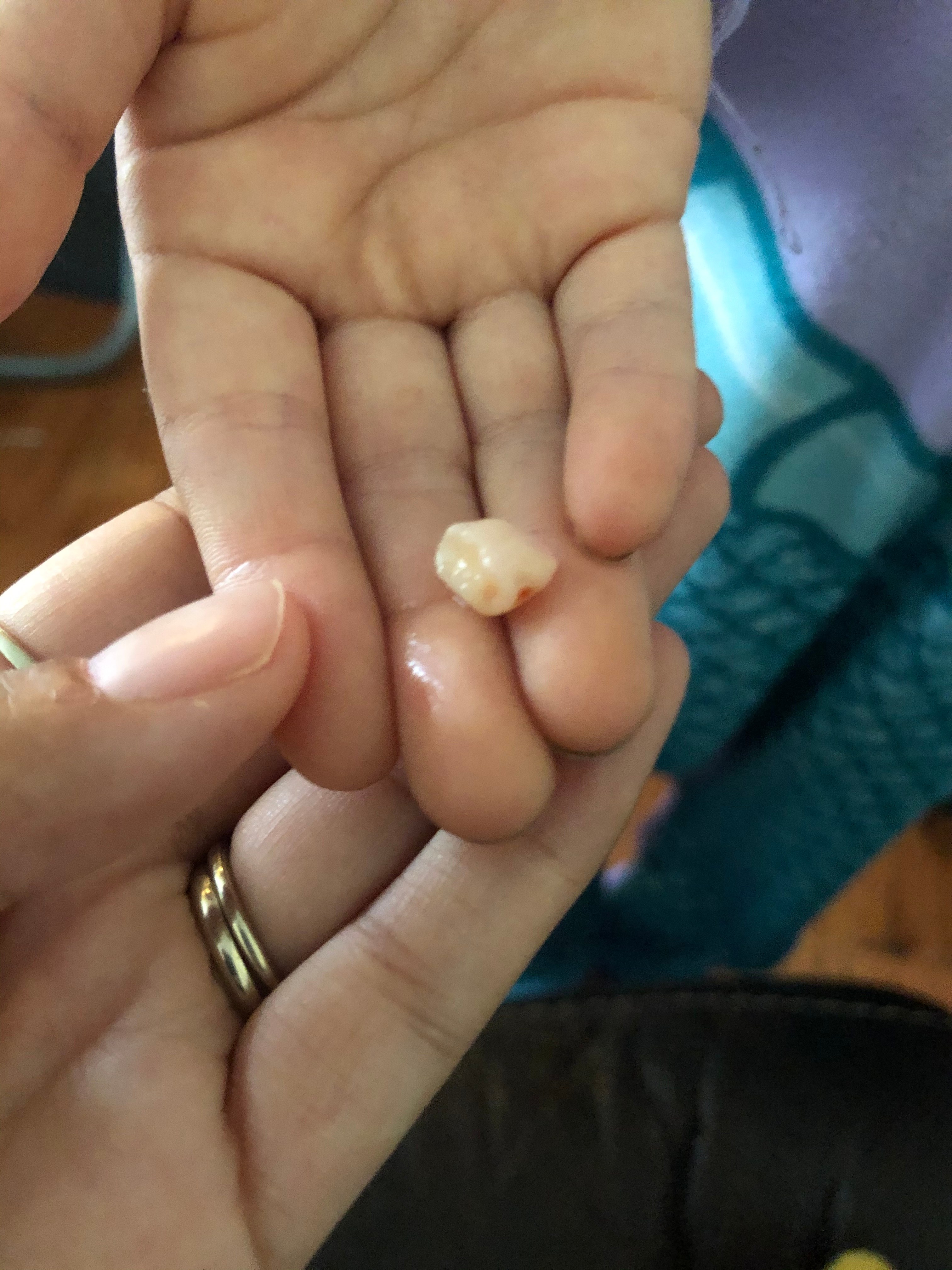 Tooth fairy isn’t cancelled / myLot