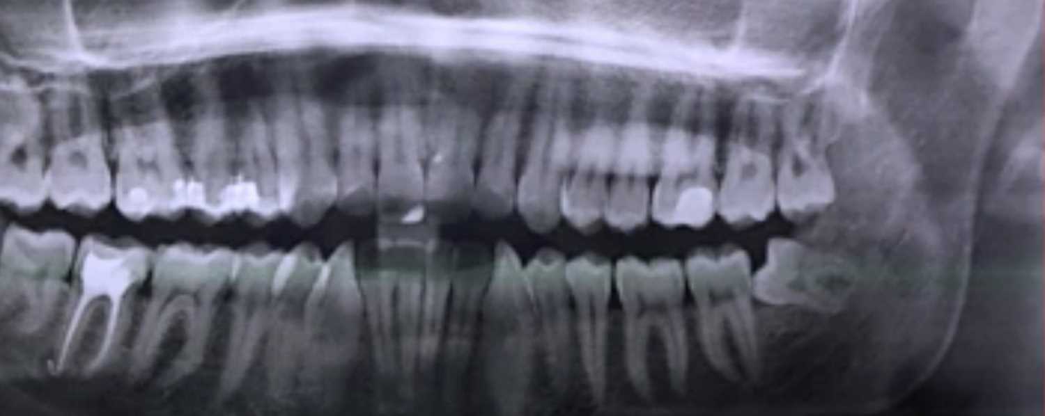 醴 Oral Surgery Dental Video Courses by