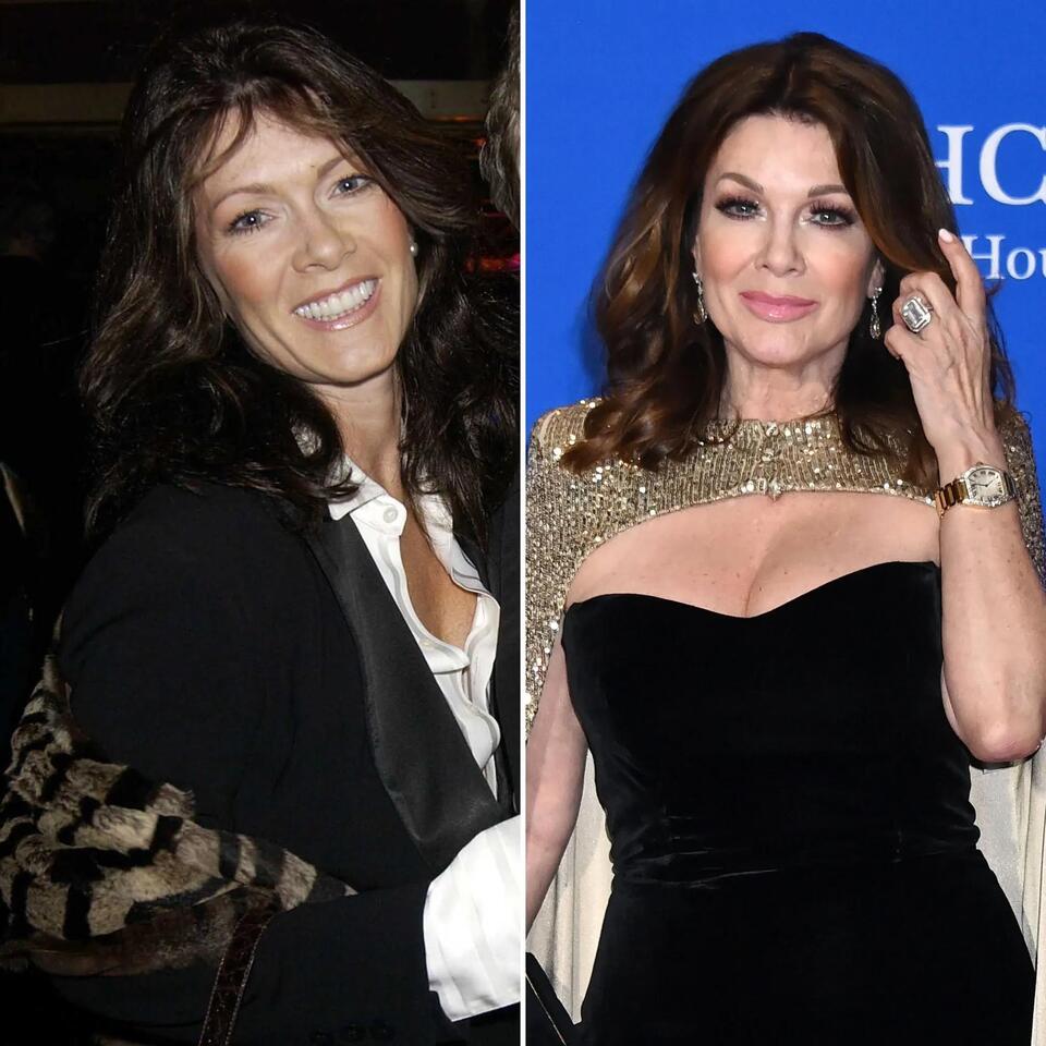 Lisa Vanderpump’s Transformation Is Incredible! See Her Then and Now
